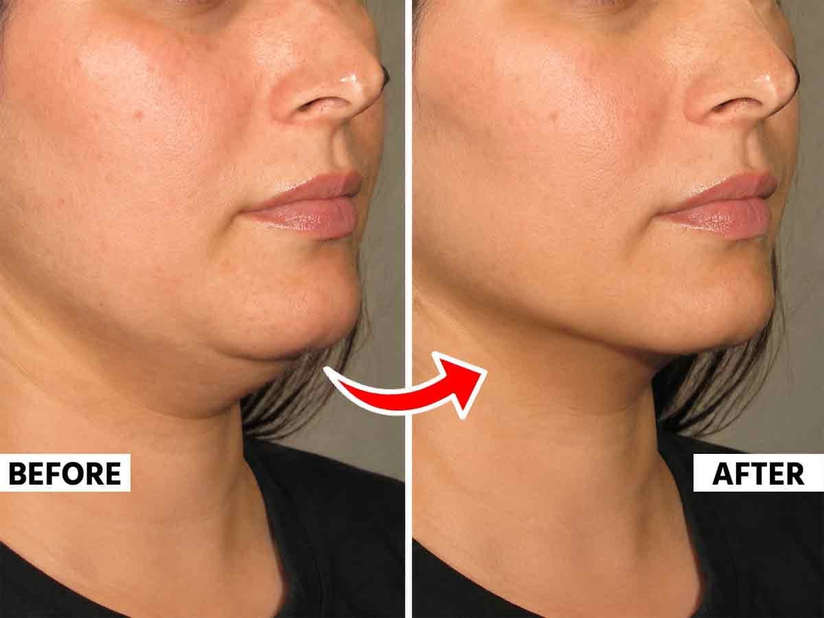 Sharp Jawline Tips:जॉलाइन कशी तीव्र करावी? ८ प्रभावी उपाय