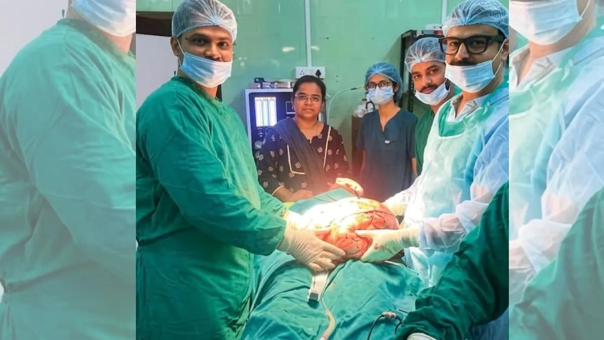 Remarkable Surgery:महिलेच्या पोटातून १५ किलोचा मांसाचा गोळा काढला