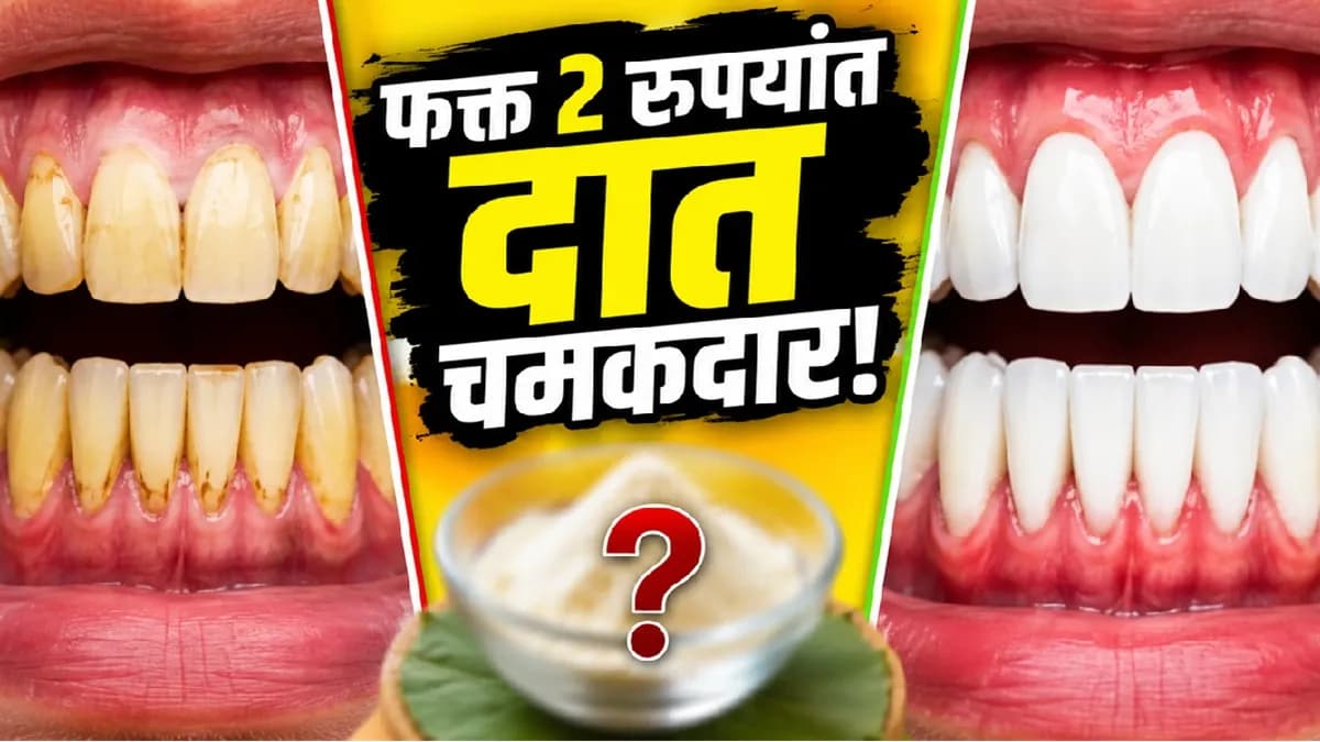 Teeth Whitening Home Remedy: दात पिवळे पडणे आणि हिरड्यांचा त्रास कमी करण्यासाठी घरगुती उपाय