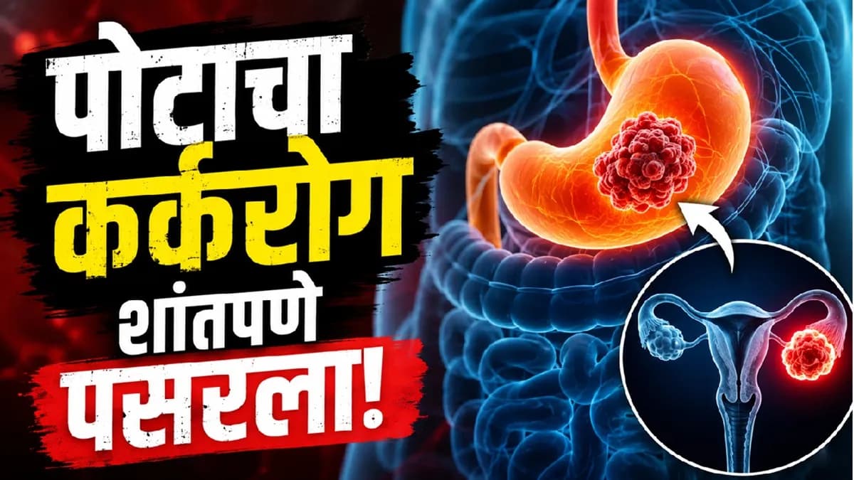 Rare Stomach Cancer Cases in Mumbai: मुंबईतील दुर्मीळ पोटाच्या कर्करोगाच्या प्रकरणांची माहिती