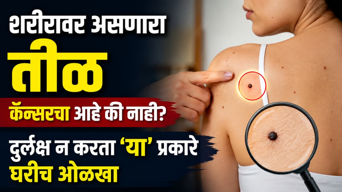 Skin Cancer Awareness:त्वचेवरील कर्करोगाची लक्षणे आणि त्याची ओळख