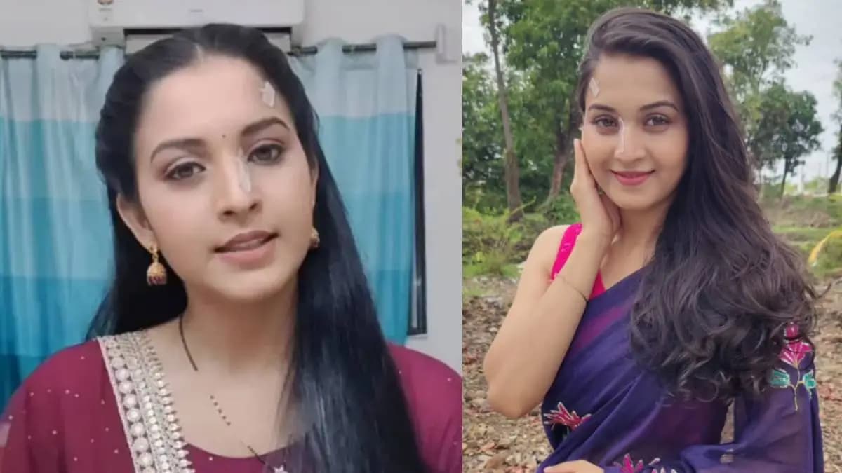 Marathi Actress Update: महिमा म्हात्रेच्या नाकावर पट्टी, चाहते चिंतित