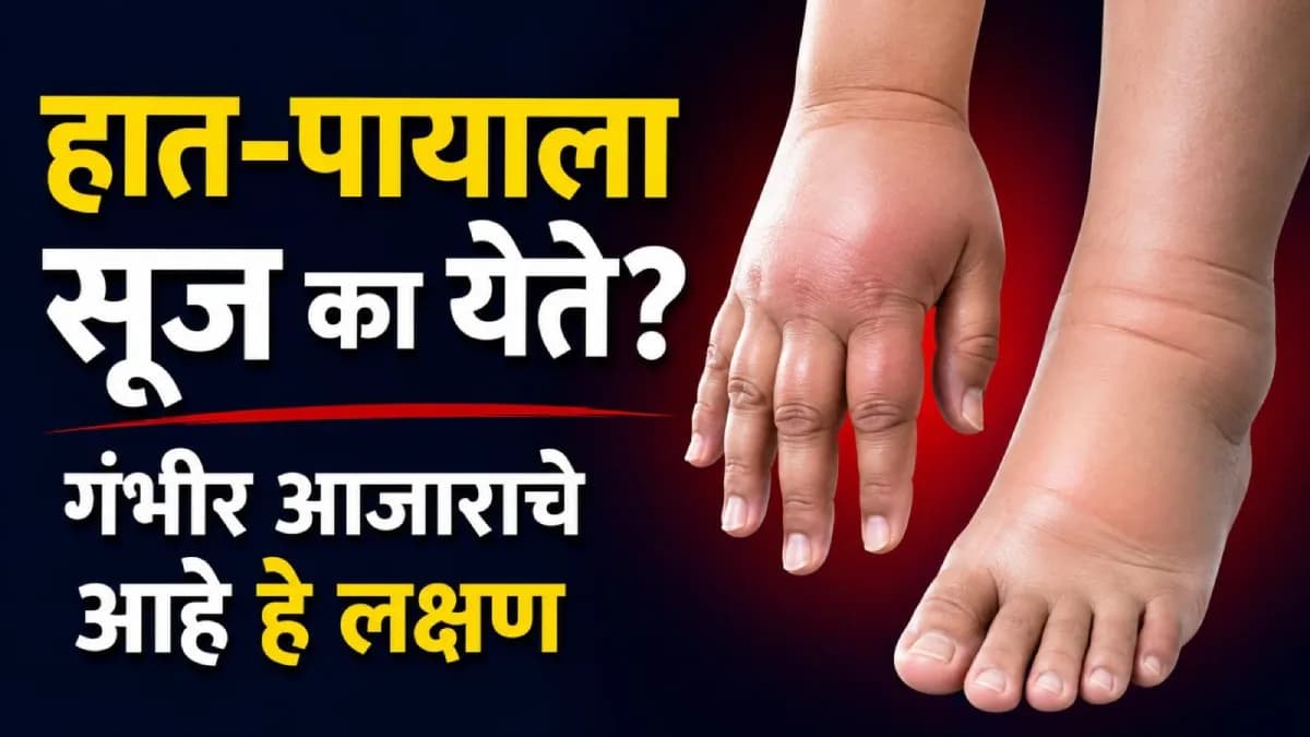 Early Signs of Lymphedema: हात-पायाला वारंवार सूज येत असल्यास काळजी घ्या